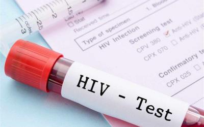 چگونه عفونت HIV بیماری “ایدز” نمی‌شود؟!